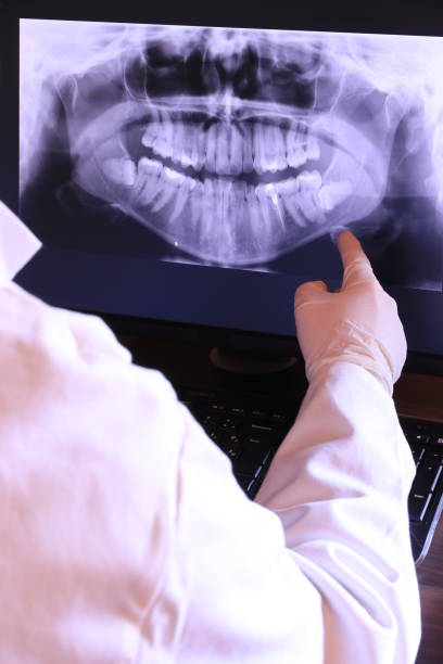 Best Emergency Dental Care for Broken or Chipped Teeth in Garden City, SC