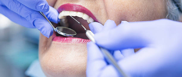 Best Emergency Wisdom Teeth Removal in Garden City, SC