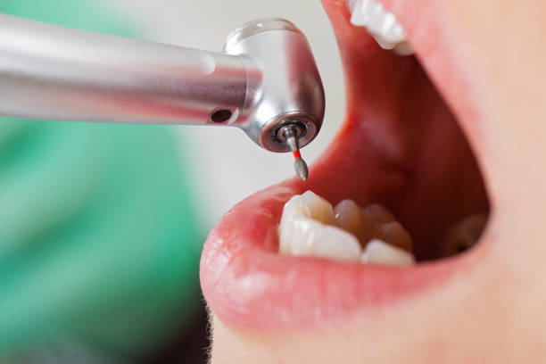 Best Pediatric Emergency Dentist in Garden City, SC